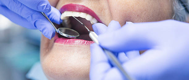 Best Urgent Care for Lost Fillings or Crowns in Montebello, CA